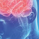 Інсульт - хвороба століття