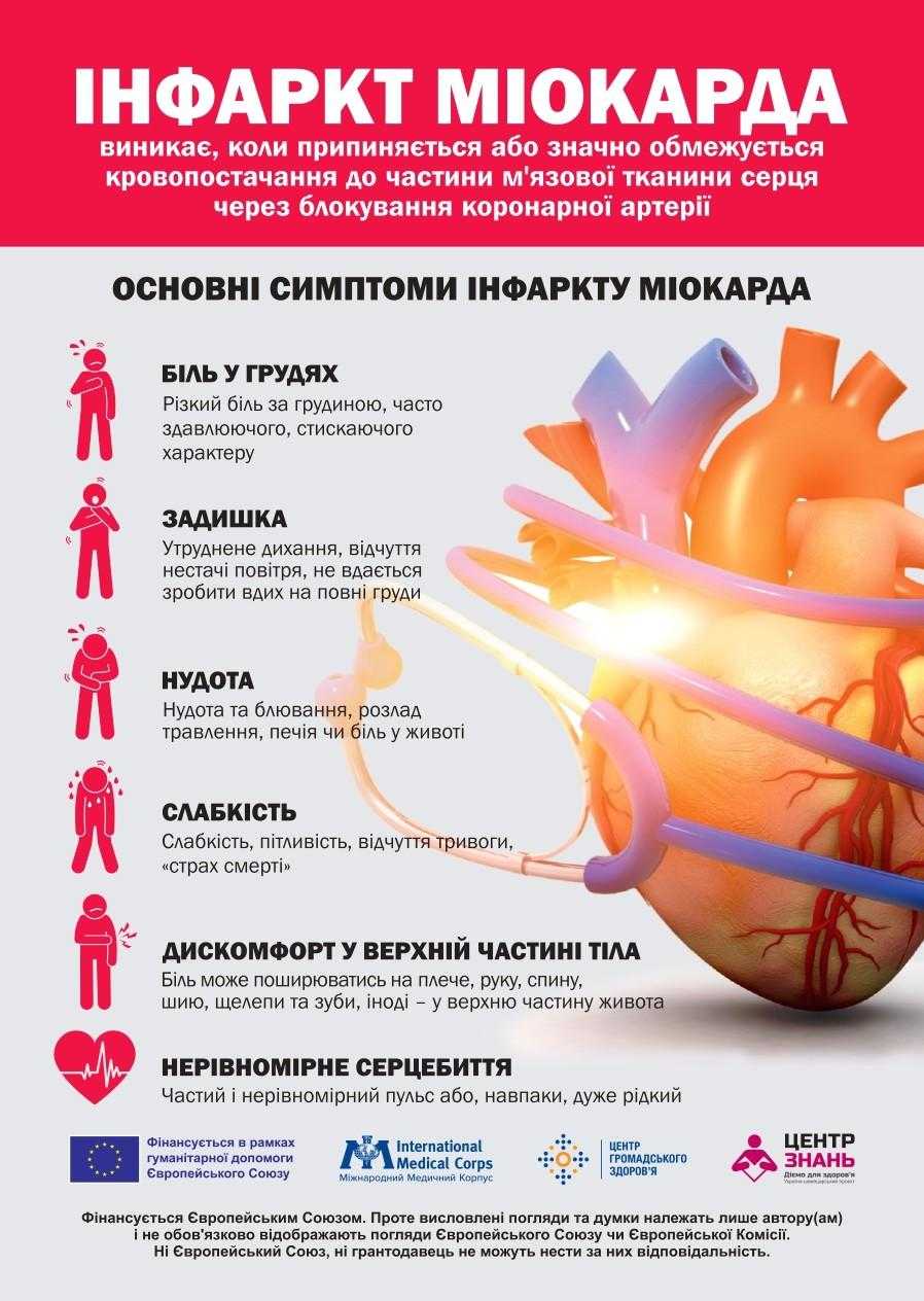 Інфаркт міокарда